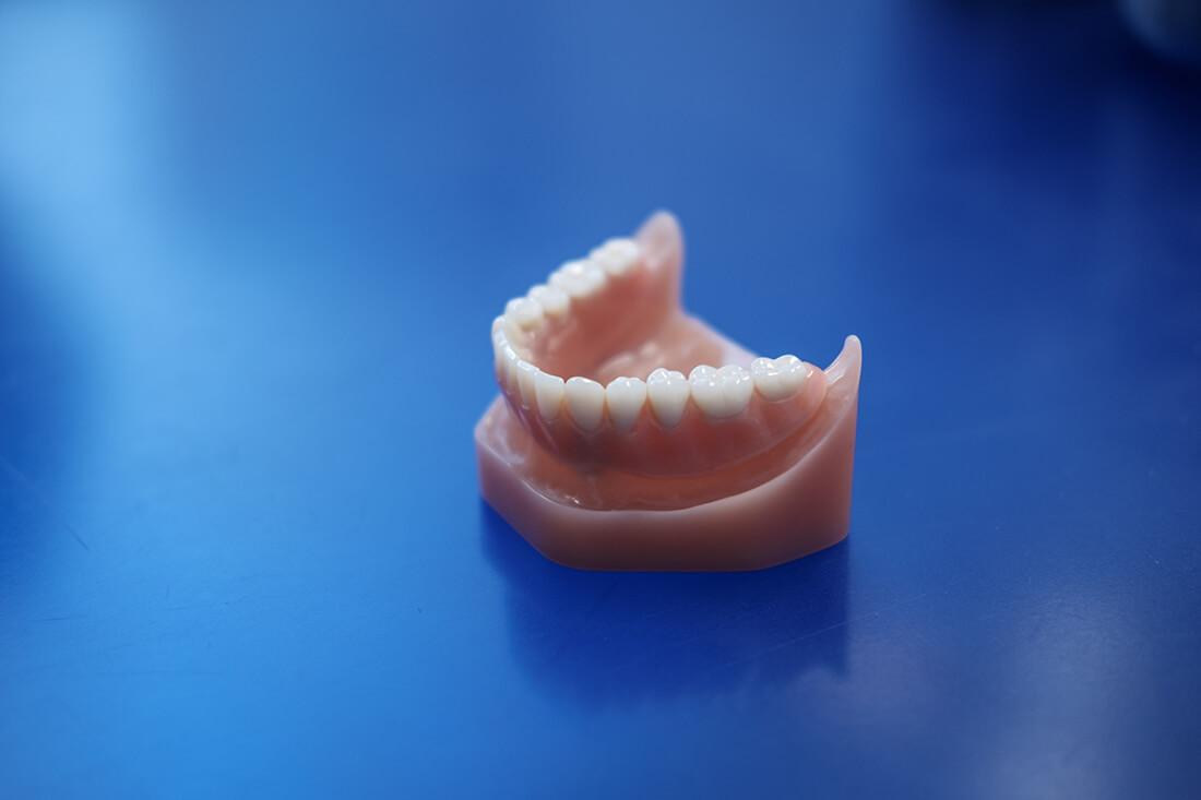 Mund-, Kiefer- und Gesichtschirurgie Hannover – Bothe – Zahnersatz in unserer Praxis Mund-, Kiefer- und Gesichtschirurgie Hannover - Bothe - Zahnersatz in unserer Praxis